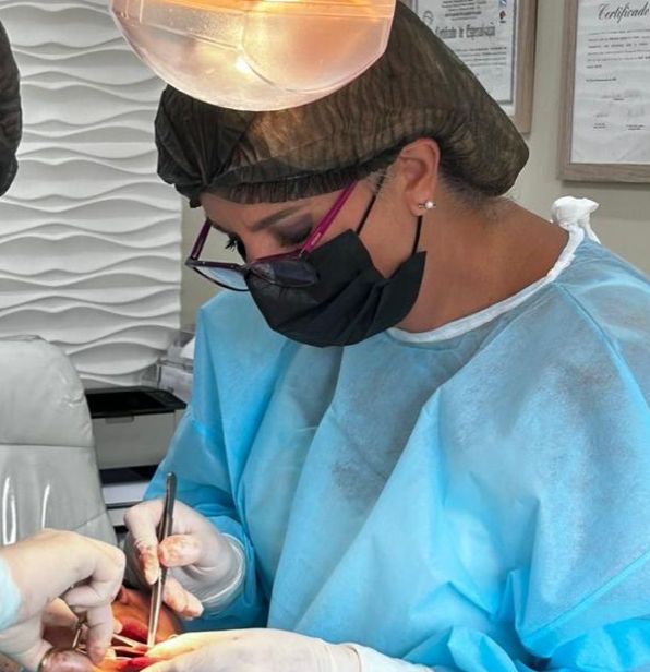 Implantes Dentários